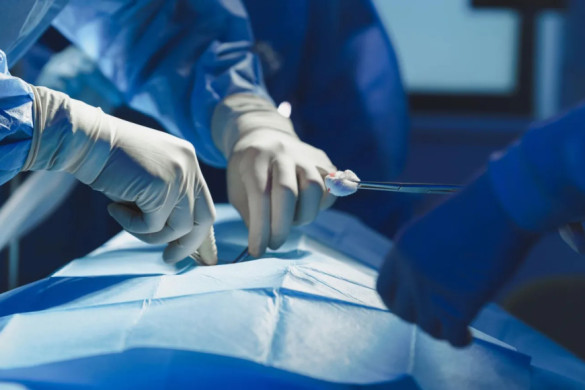 Indian doctors remove teen's 'parasitic' twin in rare surgery