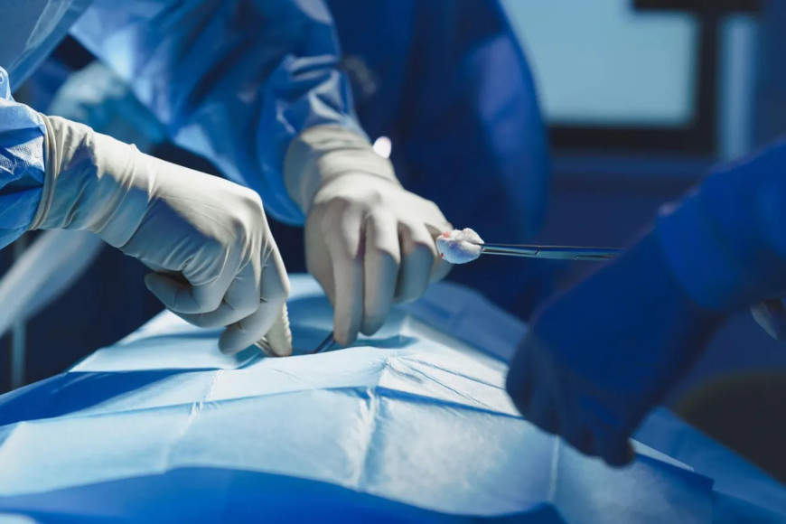 Indian doctors remove teen's 'parasitic' twin in rare surgery