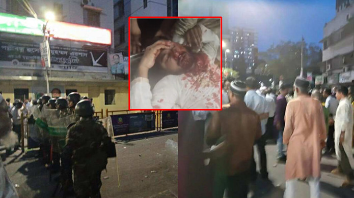 Clashes in Front of Jatiya Party Office, Gonodhikar Parishad’s Nurul Haque Nur Seriously Injured