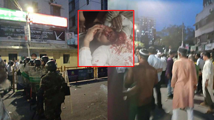Clashes in Front of Jatiya Party Office, Gonodhikar Parishad’s Nurul Haque Nur Seriously Injured